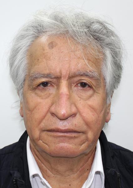 VIRGILIO ACUÑA PERALTA, Primer Vicepresidente de PARTIDO DEMOCRATICO FEDERAL para elecciones Peru 2026